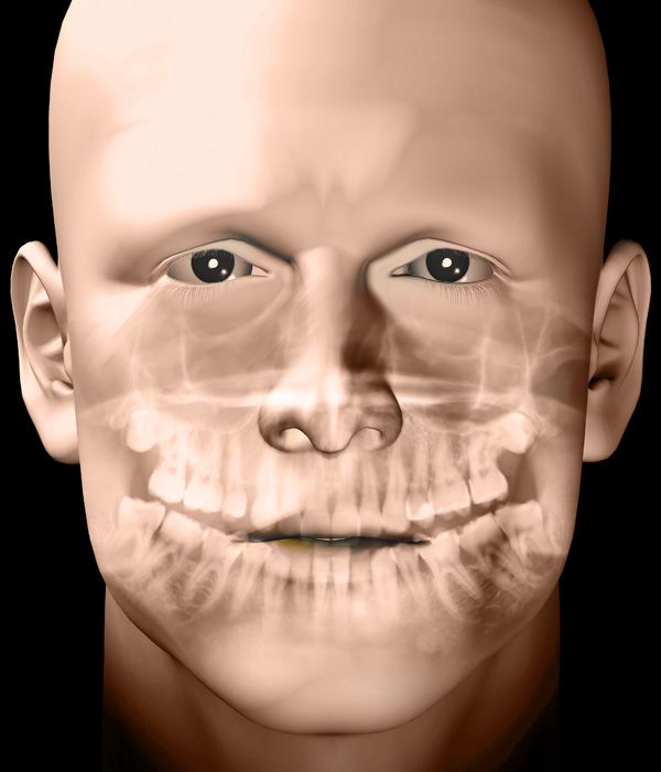 Illustration of facial bones